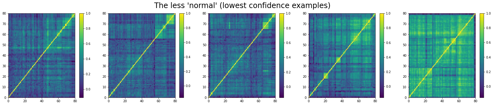 The bottom 5 'normal' correlation matrices in the test set according to the model
